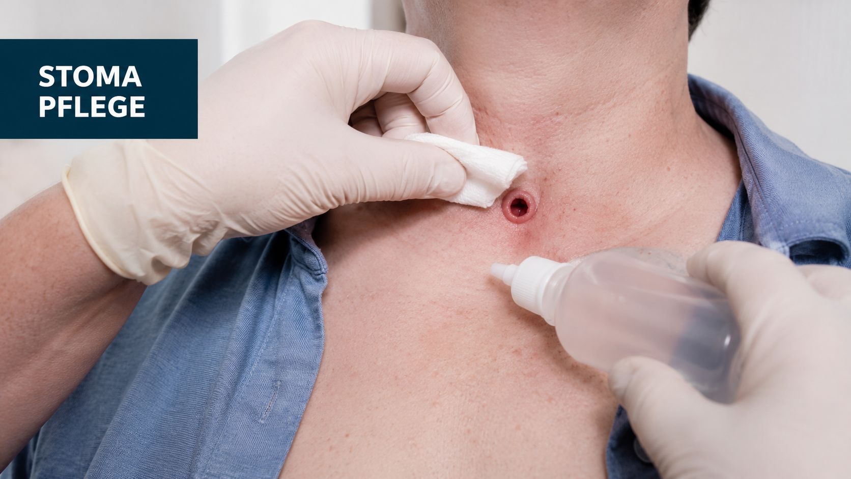 Eine medizinische Fachkraft führt fachgerecht eine sorgfältige Tracheostoma-Pflege bei einem Patienten zu Hause durch.