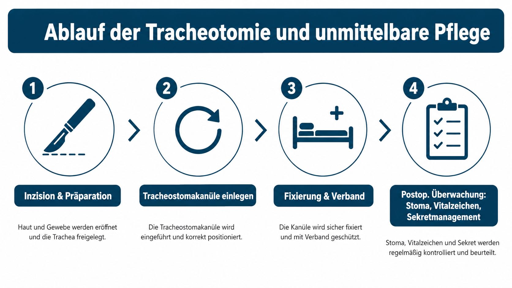 Infografik zeigt die vier Schritte von der Tracheotomie bis zur postoperativen Versorgung und täglichen Überwachung des Patienten.